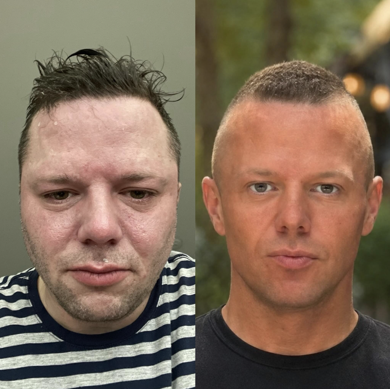 Before and after: Evan in active addiction and Evan in recovery